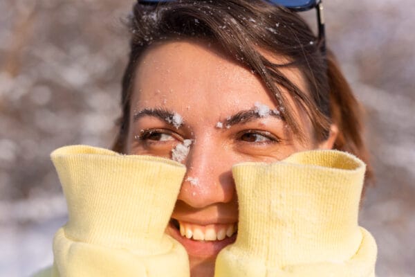 doffe huid winter stralen